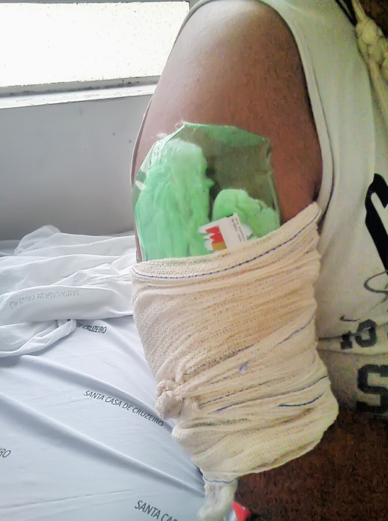 Garrafa pet é improvisada como tala no braço de paciente, em Cruzeiro (Foto: Reprodução)